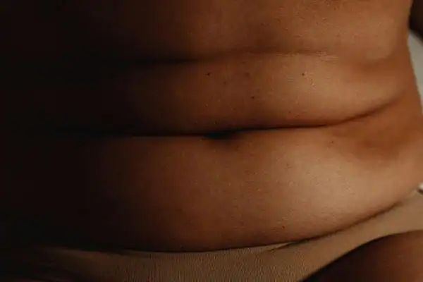 The Hidden Connection: How Stress Shapes Your Fitness and Body Composition 3 image of what stress can do on the stomach area and how Lipo 360 Solihull can help to change your body shape.